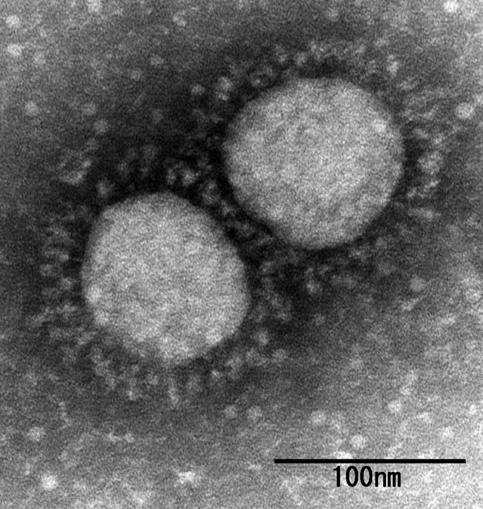 新型コロナウイルスの電子顕微鏡写真